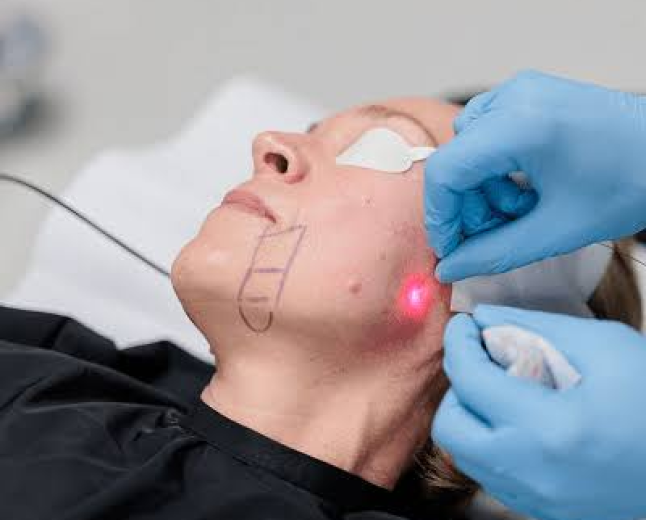 Non-surgical Face Lifting In Dubai: Lift Without Surgery