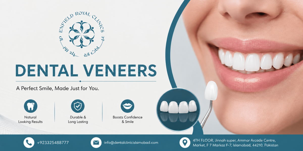 Explore Modern Options for Dental Veneers