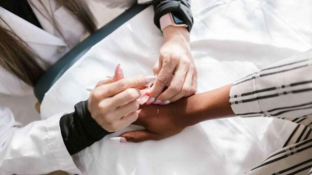 Microneedling Acupuncture Aftercare: 5 Tips for Faster Healing