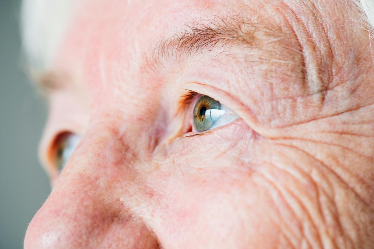 Diabetic Cataract: Why High Blood Sugar Clouds Your Vision
