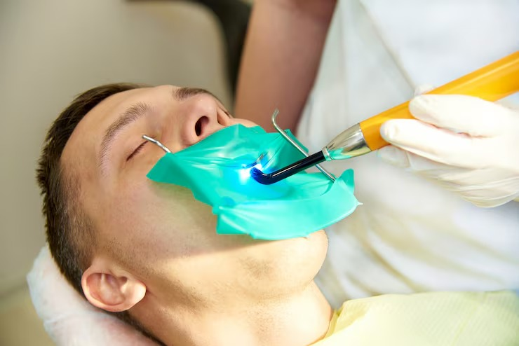 How Dental Cleaning Burbank Services Support Healthy Smiles and Dental Implant Care
