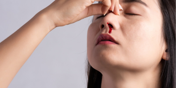 Nose Bleeding in Hot Weather: Causes, Home Care, and Prevention Tips