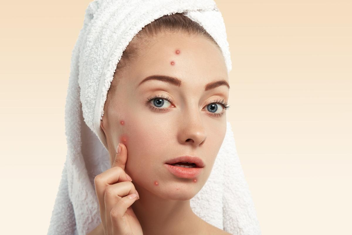 Face Pigmentation Explained: Causes, Treatments and Expert Care at the Best Dermatology Hospital in Greater Noida