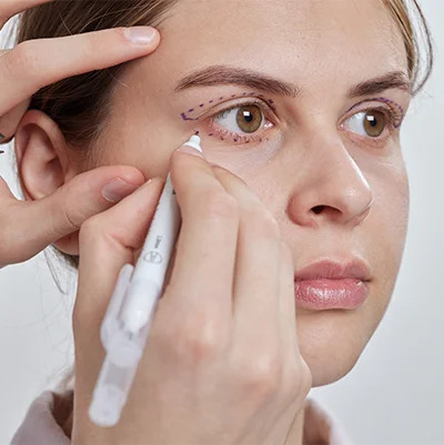 Lower Blepharoplasty In Dubai: Refine Your Lower Eyelid Appearance