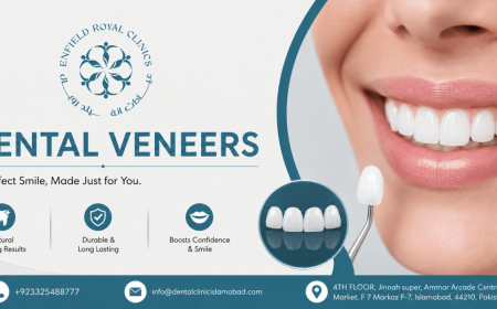 Explore Modern Options for Dental Veneers