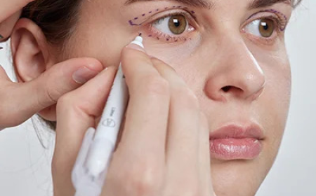 Lower Blepharoplasty In Dubai: Refine Your Lower Eyelid Appearance