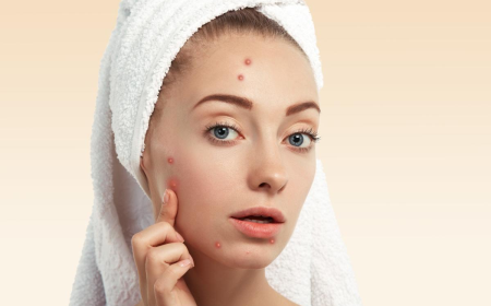 Face Pigmentation Explained: Causes, Treatments and Expert Care at the Best Dermatology Hospital in Greater Noida
