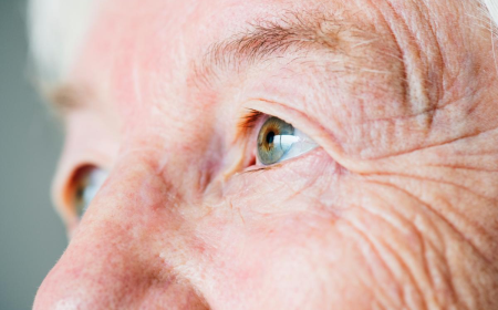 Diabetic Cataract: Why High Blood Sugar Clouds Your Vision